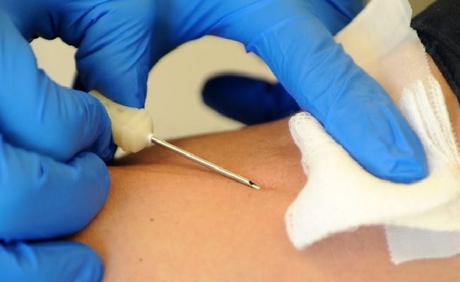 Pertosse, paura in Veneto per tre neonate contagiate